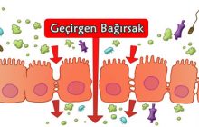 GEÇİRGEN BAĞIRSAK SENDROMU NEDİR? NEDENLERİ VE TEDAVİ YÖNTEMLERİ NELERDİR?