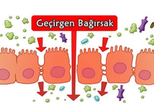 GEÇİRGEN BAĞIRSAK SENDROMU NEDİR? NEDENLERİ VE TEDAVİ YÖNTEMLERİ NELERDİR?
